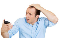 treatment-for-alopecia-areata